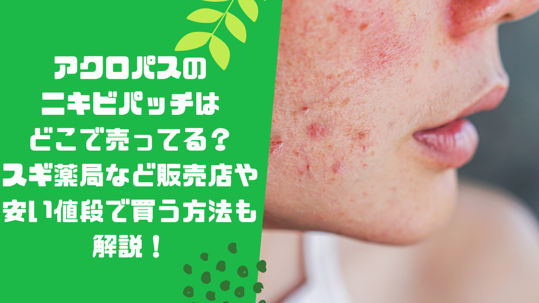 アクロパスのニキビパッチはどこで売ってる？スギ薬局など販売店や安い値段で買う方法も解説！